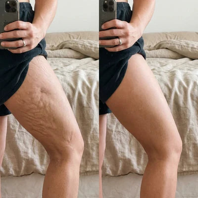 SkinSilky recension 3